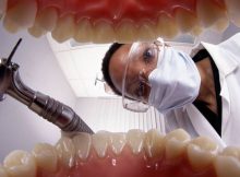 dentiste-dents-bouche-consultation-fraise-masque
